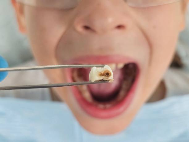 Best Emergency Broken Tooth Repair in Fern Park, FL